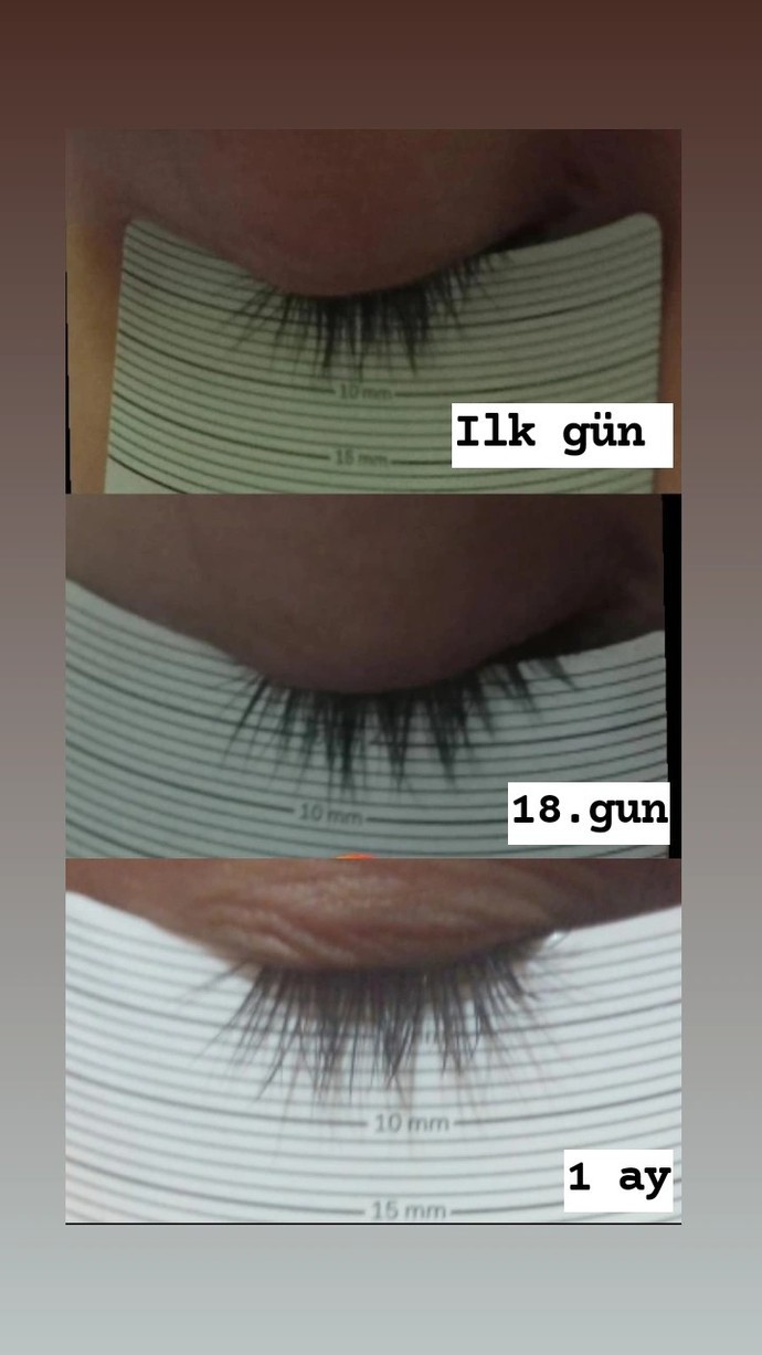 Ben 1 aydan beri kirpik serumu kullanıyorum. Sizce uzama gürleşme olmuş mu?