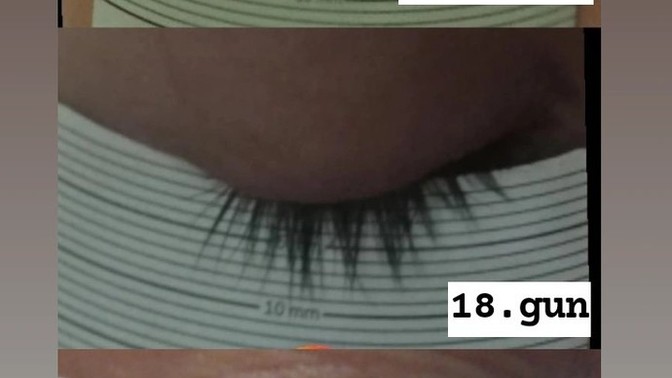 Ben 1 aydan beri kirpik serumu kullanıyorum. Sizce uzama gürleşme olmuş mu?