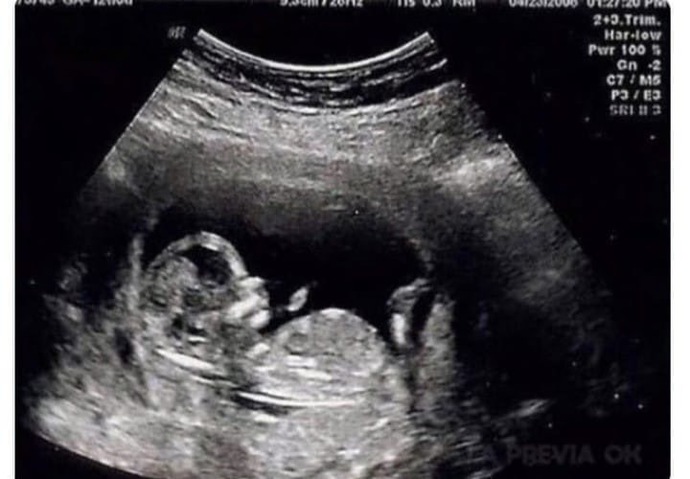 Uykunuzu en son nerede ne zaman tam olarak aldınız?