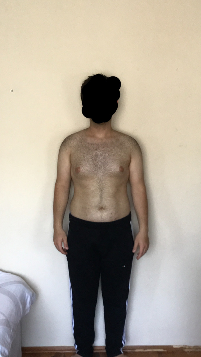 Sizce bir sorun veya hormon bozukluğu var mı çok küçük gösteriyorum (Foto yakın çekildiği için büyük görünüyor olabilirim) ?