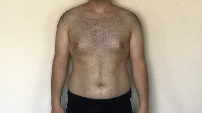 Sizce bir sorun veya hormon bozukluğu var mı çok küçük gösteriyorum (Foto yakın çekildiği için büyük görünüyor olabilirim) ?