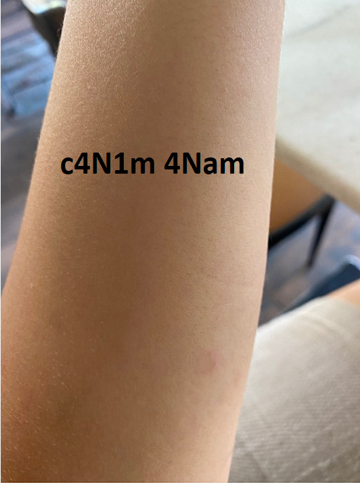 Kızamık mı oldum ben ya?