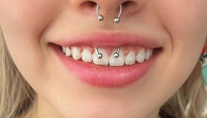 Diş piercingini nasıl buluyorsunuz?