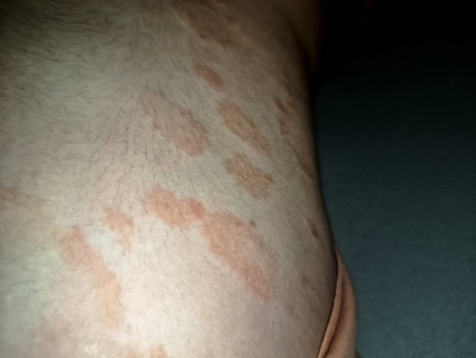 Aramızda cildiyeci var mı?