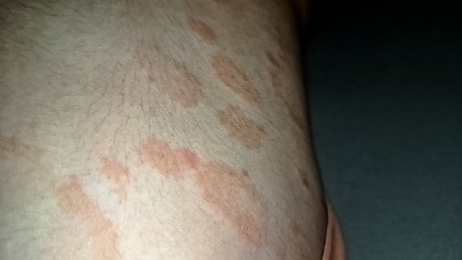 Aramızda cildiyeci var mı?