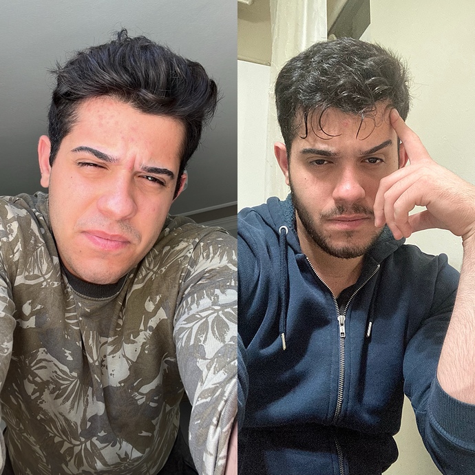 Instagramın Açılmasını Halen Daha Bekliyormusunuz?
