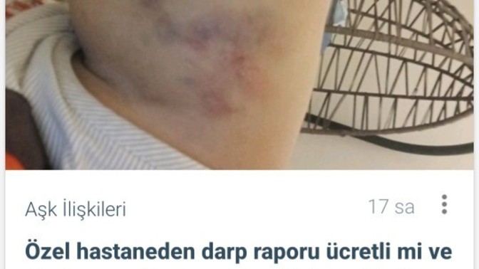 Kız arkadaşım beni dövdü darp raporu iki gün sonra alınır mı?