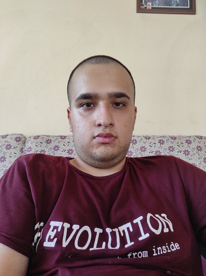 Çok ÇİRKİNİMMMMM?