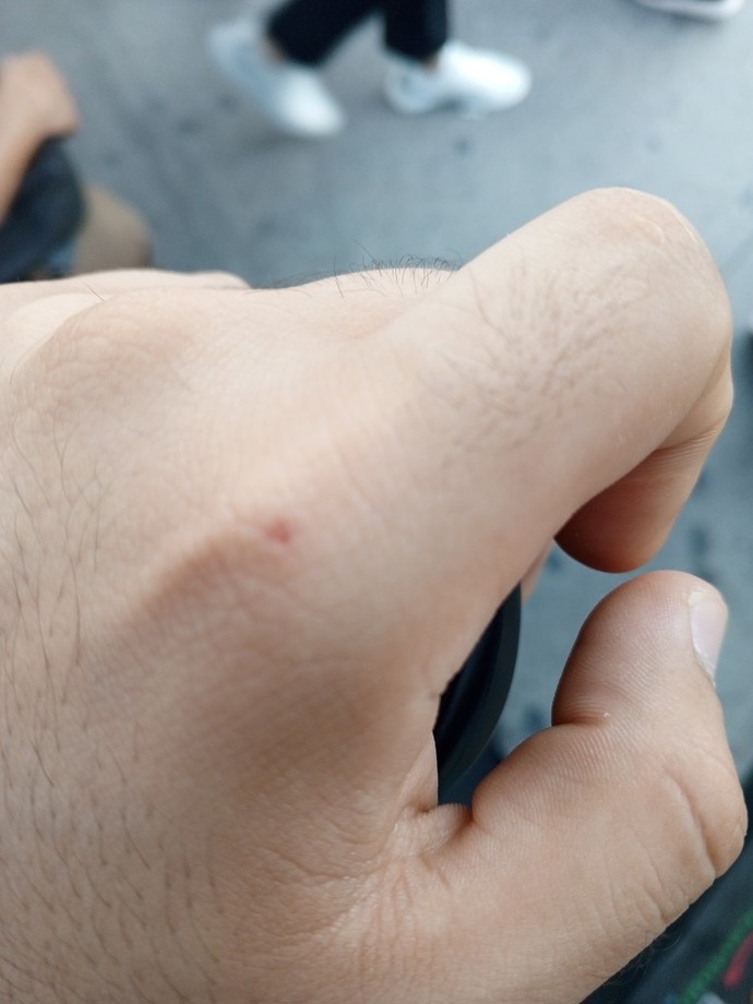 Merhaba. Size bisey sormam gerek sizce bu kedi tırmığına çizmesine benziyomu?