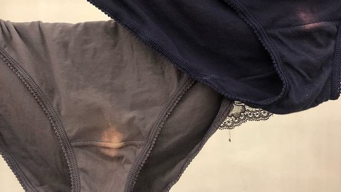 Vajinanın asit oranının iç çamaşırında renk değişikliğine sebep olduğunu biliyor muydunuz?