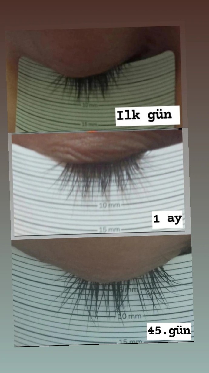 Kirpiklerim uzamış mı?
