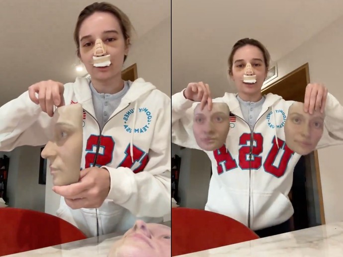 Burun estetiği olan kadın, doktorunun ameliyat öncesi ve sonrası yüzünü gösteren üç boyutlu maskeleri gösterdi. Siz nasıl buldunuz?
