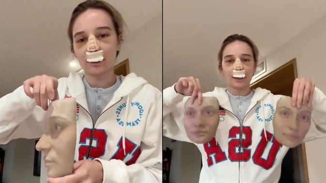 Burun estetiği olan kadın, doktorunun ameliyat öncesi ve sonrası yüzünü gösteren üç boyutlu maskeleri gösterdi. Siz nasıl buldunuz?