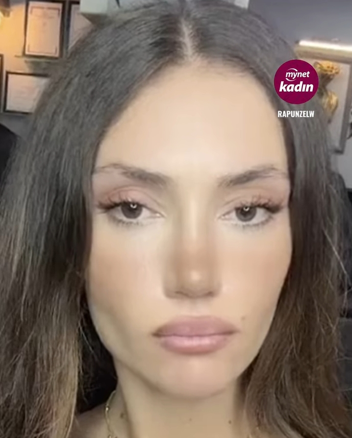 Göz rengi değiştirme ameliyatı hakkında ne düşünüyorsunuz?