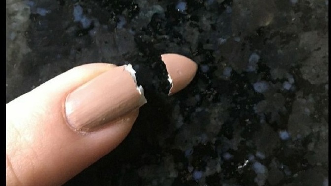Hiç protez tırnağınız kırıldı mı?