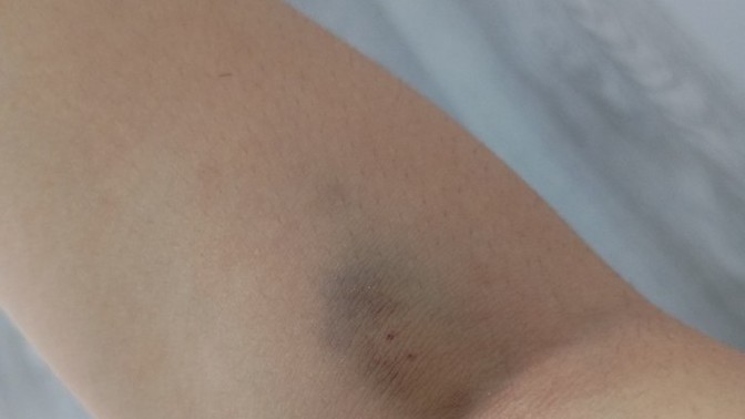Kan verdim kolum morardı, size geçer mi?