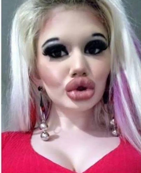 Bazı estetik yaptıran kadınlar modifiye takmış şahin gibi durmuyor mu?