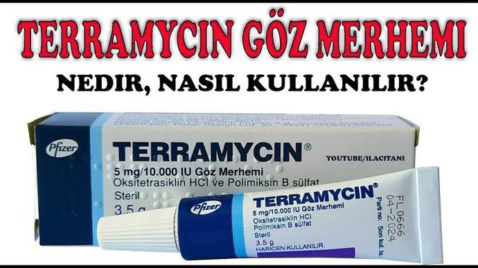 Gözlerim neden böyle olabilir? (Fotoğraf)?