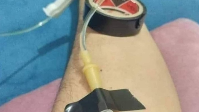 Flörtüm serümlü bu fotoğrafı attı, hastanedeyim yazamıyorum diye sizce inanmalımıyım?