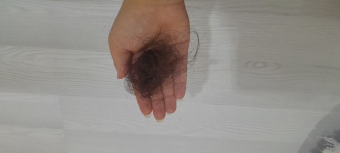 Aylardır sacim bu şekilde her tarafigimda dökülüyor?