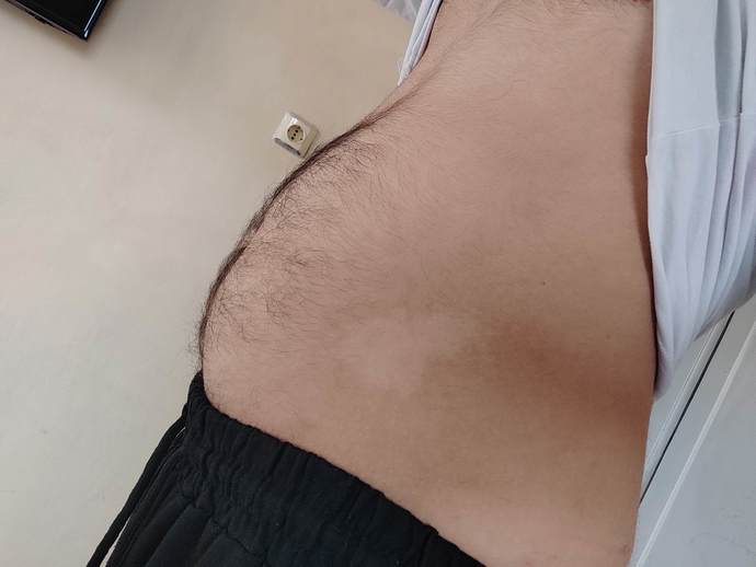 Hafif bi göbeğim var nasıl erir?