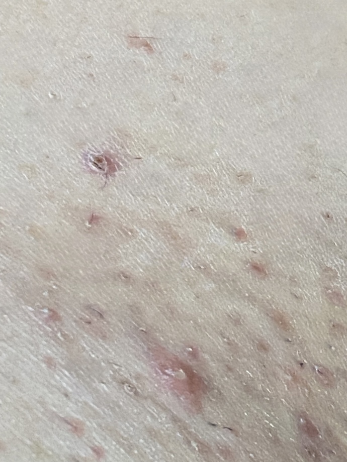 Genital bölgemi nasıl düzeltirim?
