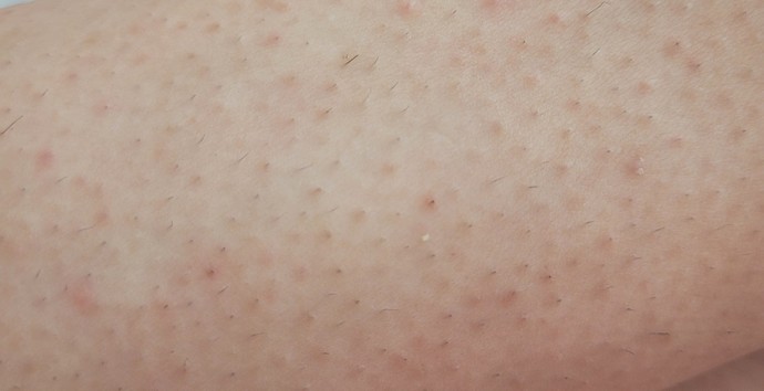 Ağdadan yeni geldim ama görüntü bu ya bence hic temiz olamayacak miyim bu nedir ya cozumu nedir bunun biri söylesin acill?
