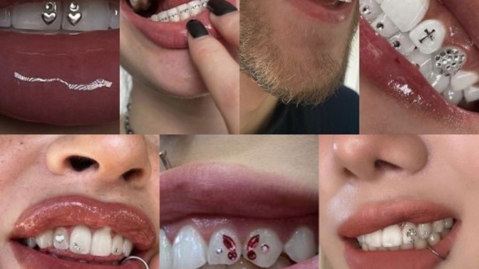 Diş kristali sizce hoş duruyor mu? Yaptırmak ister miydiniz?