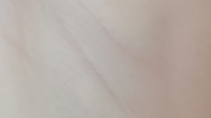 Koltuk altımı jilet ile aldım ilk kez normalde hep ağda ile alıyordum siyah nokta gibi tüylerin olması normal mi?