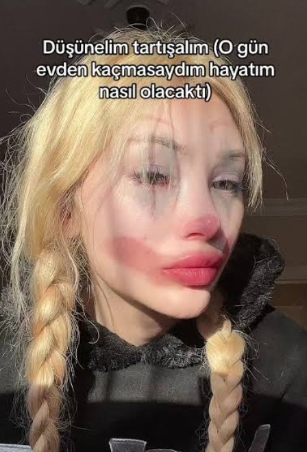 Neden Türk aileleri çocukları reşit olunca ayrı eve çıkmalarına karışıyor?