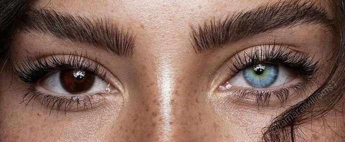 Bir göze lens takmak güzel mi sizce?
