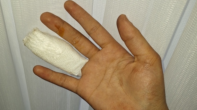 Ben yine 3üncü kez işkazası geçirdim. Geçmiş olsun alayım mı ;)?