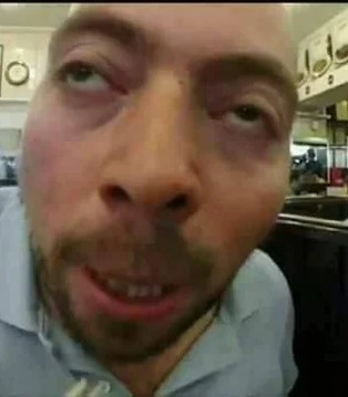 Sizce burnum kötü mü?