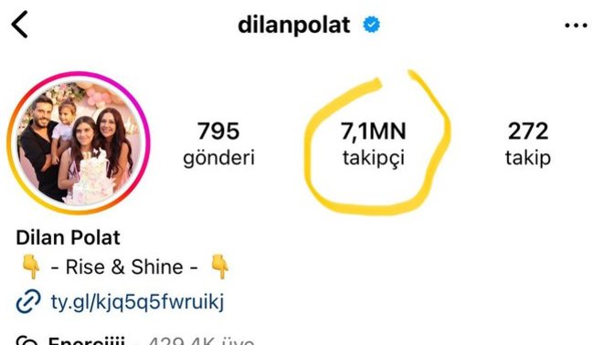 DiLan poLat'ı takip ediyormusun? Kim bu 7.1 milyon takipçi?