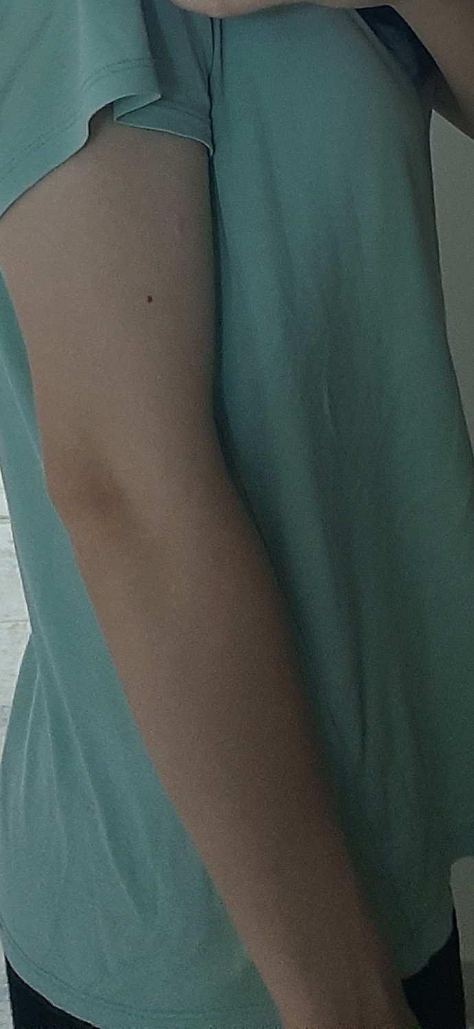 Sıradan bir kadina gore fazla mi kasliyim sanki kolumda bi çıkıntı var gibi?