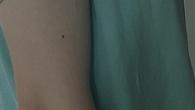 Sıradan bir kadina gore fazla mi kasliyim sanki kolumda bi çıkıntı var gibi?