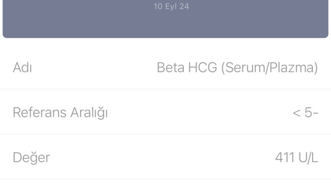 Hamile miyim nasıl anlaşılır?