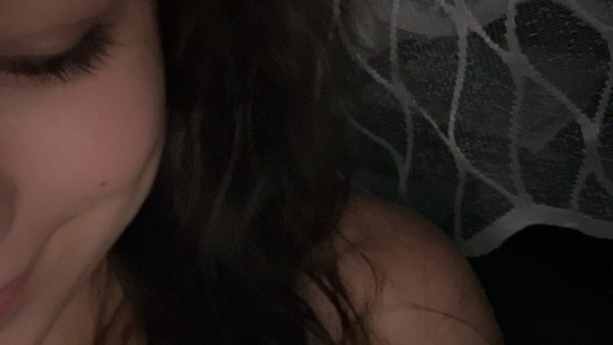 Bu resimdeki gamze mi oluyor?
