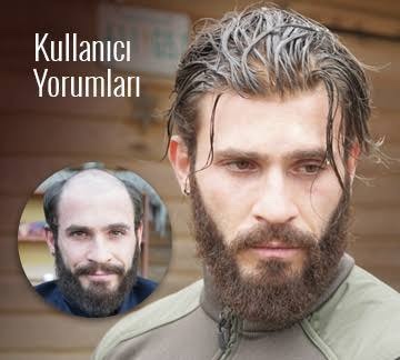 Protez saç hakkına ne düşünüyorsunuz?