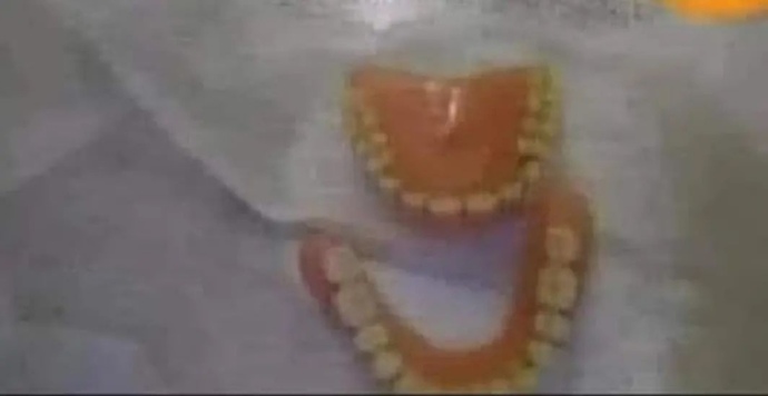 Alt üst çıkma damak, nakit sıkıntısından dolayı satıyorum az kullanılmış, sizce iyi fiyata alan olur mu?🤭🤭?