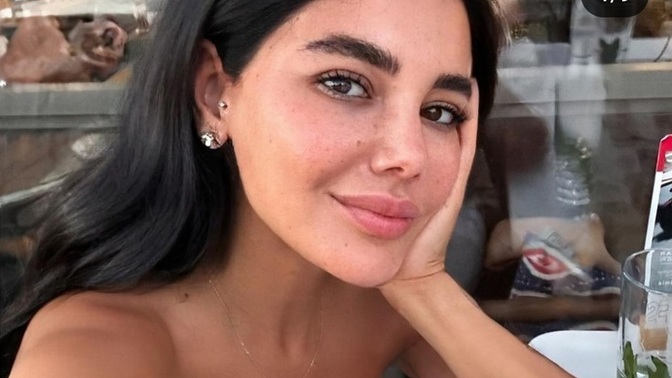 Botoksunuz var mı, bu kadın kaç yaşında tahmin edin bir de xcxcx?