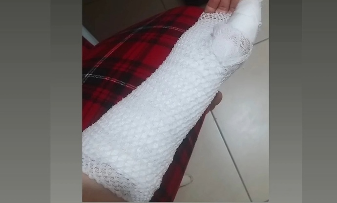 Kaza geliyorum dermi?