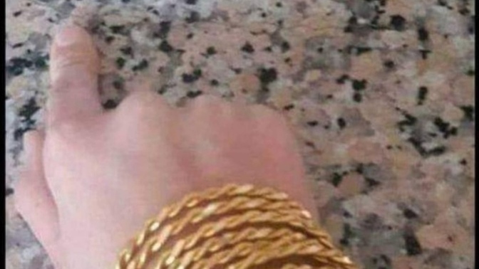 Parmağımla gösterdiğim yerde mutfak taşı çatlamış ne yapmam gerek?🤭🤭🤭?