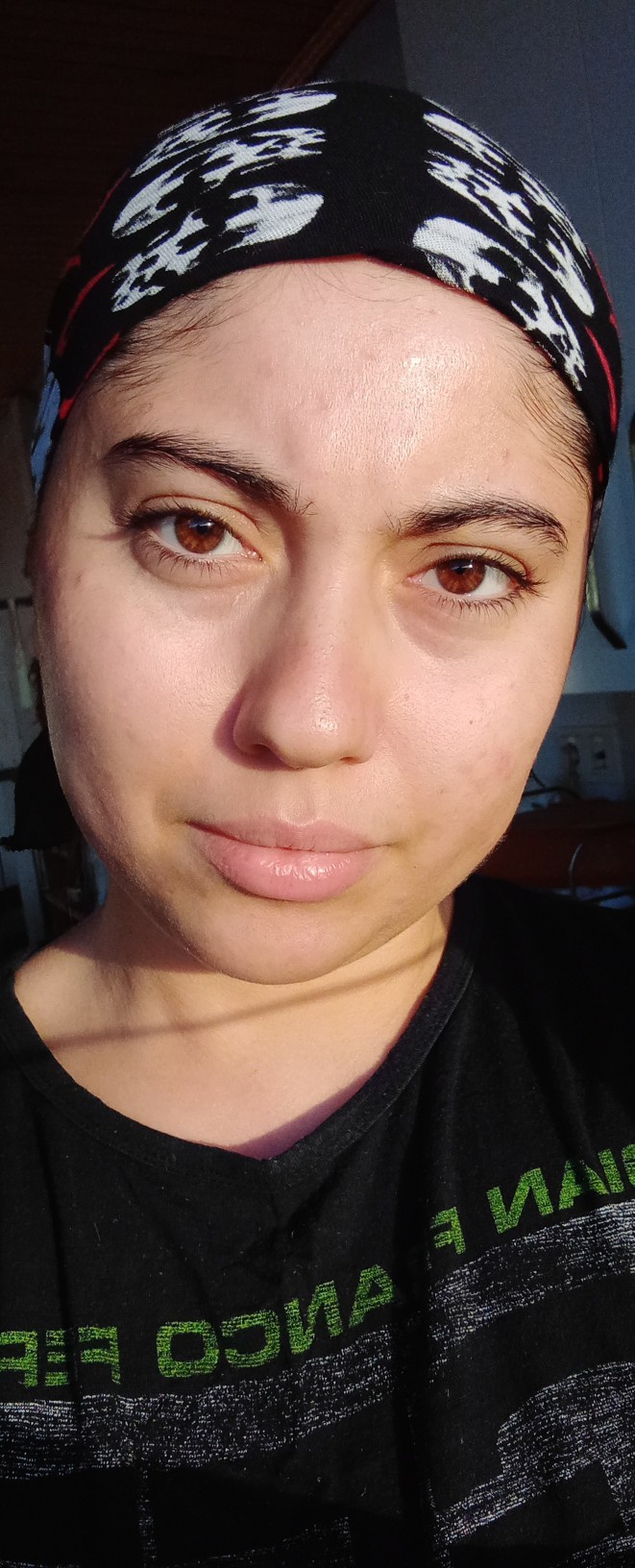 Cildim iyileşmiş mi?
