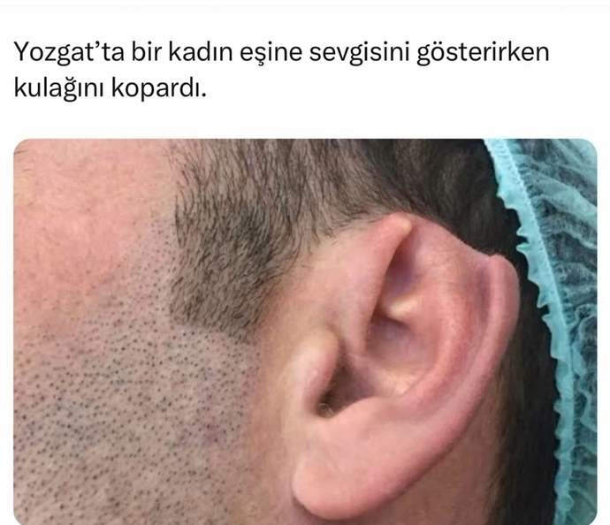 Sevginizi gösterirken abartılı davranışlar sergiliyor musunuz?