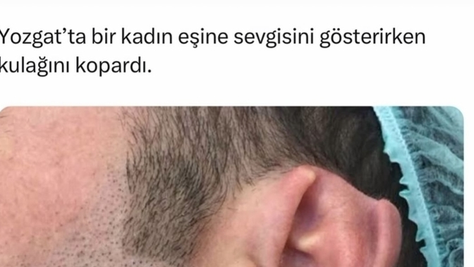 Sevginizi gösterirken abartılı davranışlar sergiliyor musunuz?