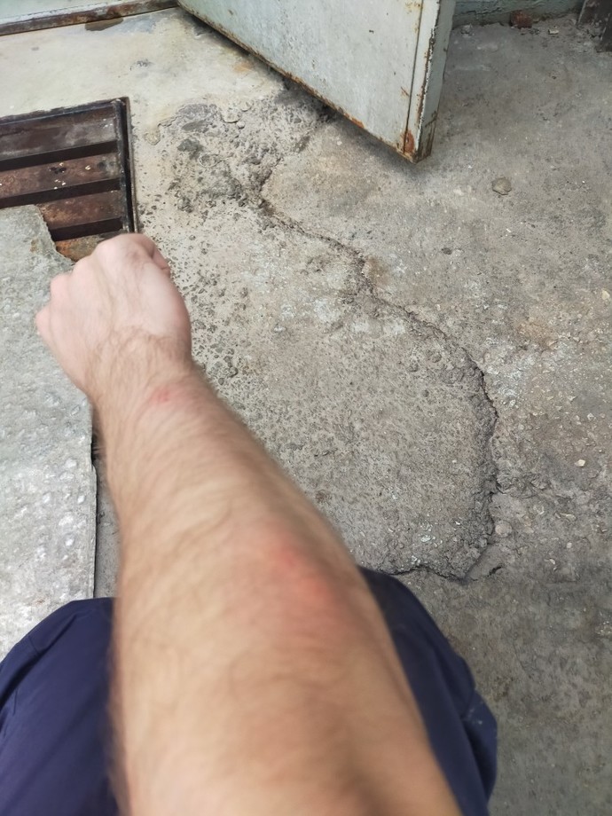 Bunlar ne izi arkadaşlar böyle yaralar çıktı kolumda?