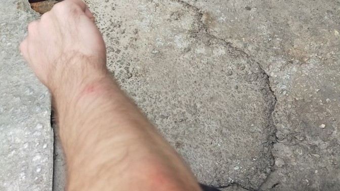 Bunlar ne izi arkadaşlar böyle yaralar çıktı kolumda?