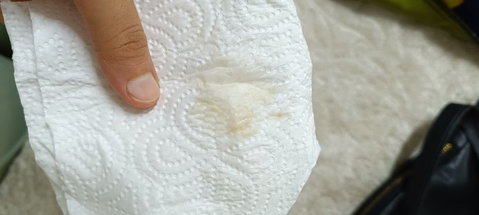 Hamiliyim böyle bir leke geldi normal mi?