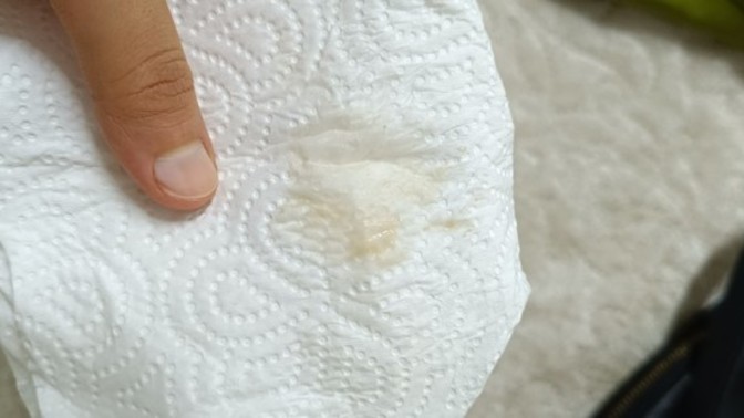 Hamiliyim böyle bir leke geldi normal mi?